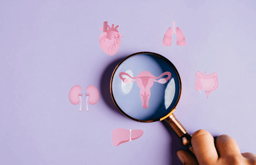 Polycystic ovary syndrome (PCOS): understand, manage and live with it