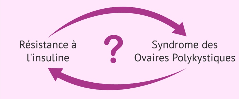 Illustration: insulin resistance and ovaries link
